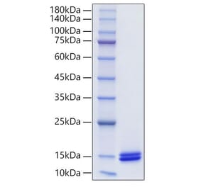 SDS-PAGE - Recombinant Human CCL14 Protein (C-terminal His Tag) (A330198) - Antibodies.com