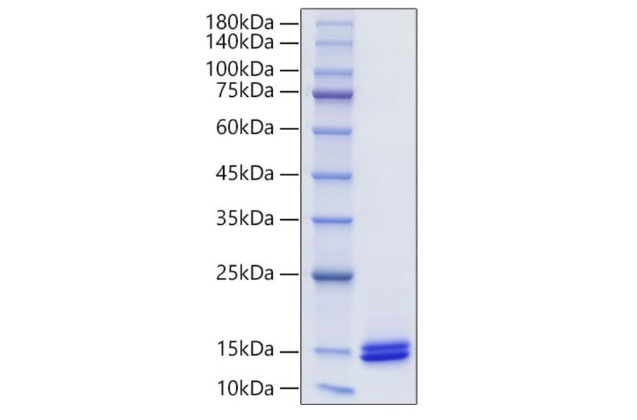SDS-PAGE - Recombinant Human CCL14 Protein (C-terminal His Tag) (A330198) - Antibodies.com