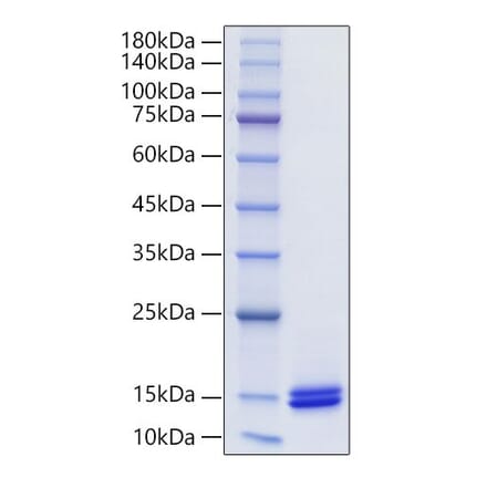 SDS-PAGE - Recombinant Human CCL14 Protein (C-terminal His Tag) (A330198) - Antibodies.com