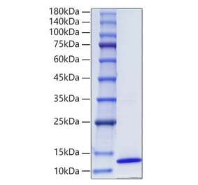 SDS-PAGE - Recombinant Human CCL17 Protein (C-terminal His Tag) (A330199) - Antibodies.com