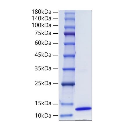 SDS-PAGE - Recombinant Human CCL17 Protein (C-terminal His Tag) (A330199) - Antibodies.com