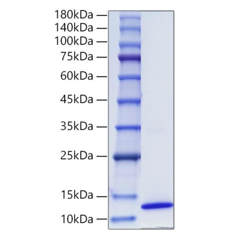 SDS-PAGE - Recombinant Human CCL17 Protein (C-terminal His Tag) (A330199) - Antibodies.com