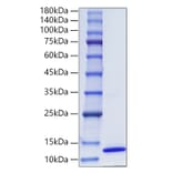 SDS-PAGE - Recombinant Human CCL17 Protein (C-terminal His Tag) (A330199) - Antibodies.com