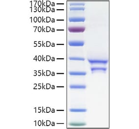 SDS-PAGE - Recombinant Human CCL17 Protein (C-terminal Human Fc and His Tag) (A330200) - Antibodies.com