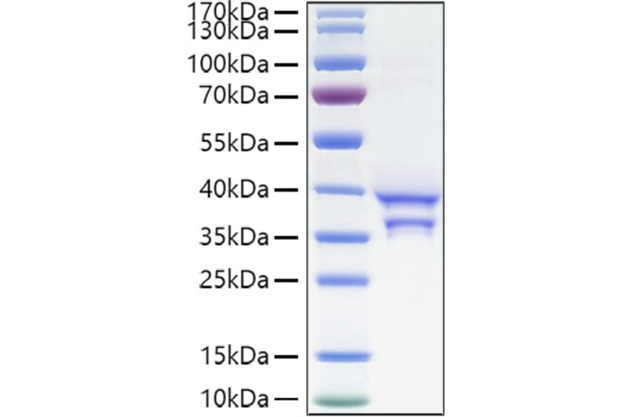 SDS-PAGE - Recombinant Human CCL17 Protein (C-terminal Human Fc and His Tag) (A330200) - Antibodies.com