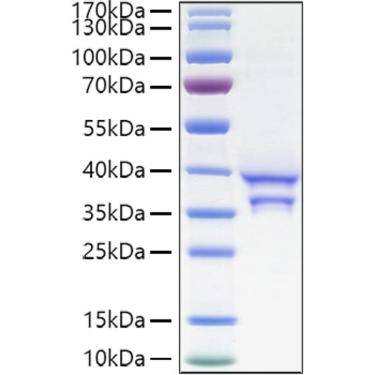 SDS-PAGE - Recombinant Human CCL17 Protein (C-terminal Human Fc and His Tag) (A330200) - Antibodies.com