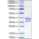 SDS-PAGE - Recombinant Human CCL17 Protein (C-terminal Human Fc and His Tag) (A330200) - Antibodies.com