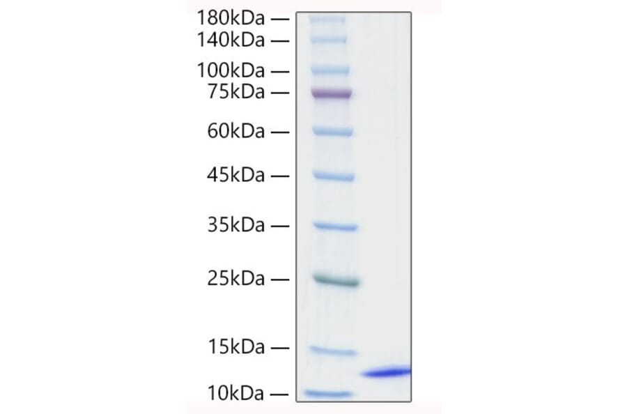 SDS-PAGE - Recombinant Human CCL18 Protein (A330201) - Antibodies.com