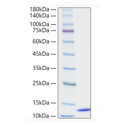 SDS-PAGE - Recombinant Human CCL18 Protein (A330201) - Antibodies.com
