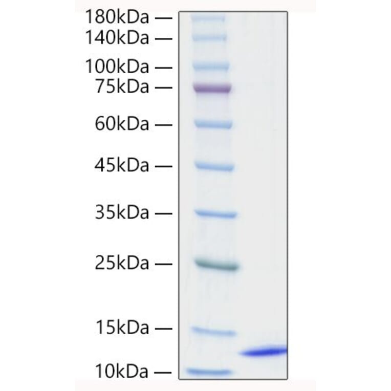 SDS-PAGE - Recombinant Human CCL18 Protein (A330201) - Antibodies.com
