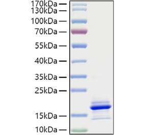 SDS-PAGE - Recombinant Human CCL21 Protein (A330202) - Antibodies.com