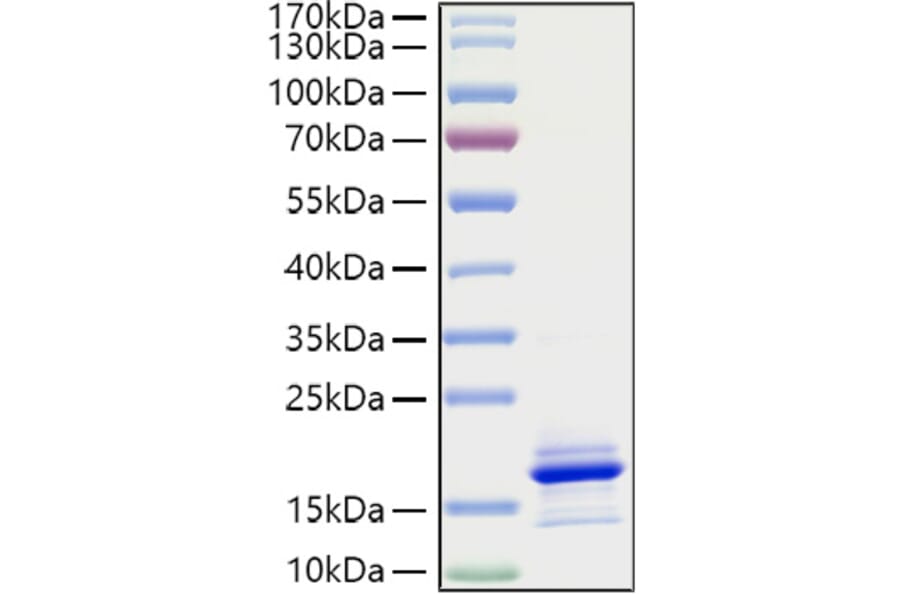 SDS-PAGE - Recombinant Human CCL21 Protein (A330202) - Antibodies.com