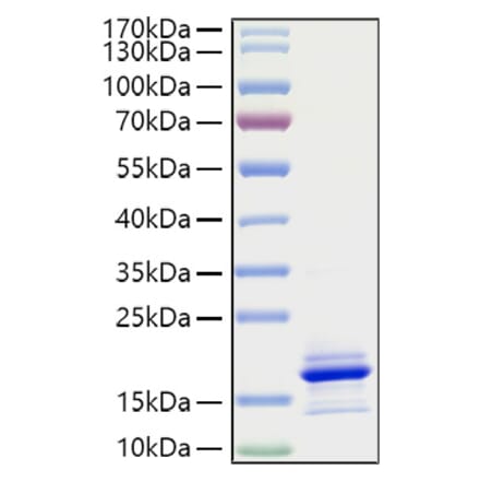 SDS-PAGE - Recombinant Human CCL21 Protein (A330202) - Antibodies.com