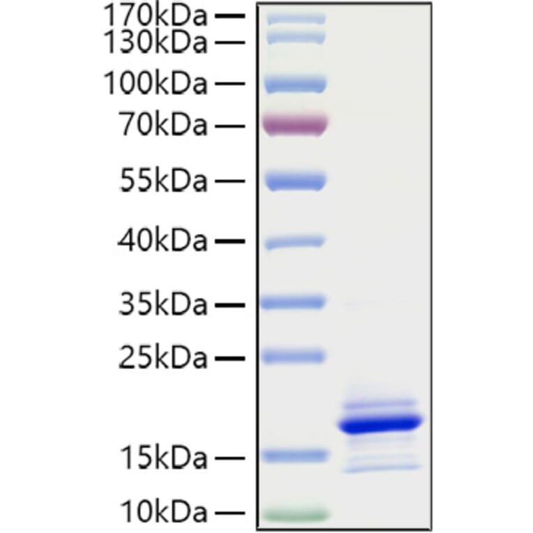 SDS-PAGE - Recombinant Human CCL21 Protein (A330202) - Antibodies.com