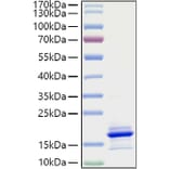 SDS-PAGE - Recombinant Human CCL21 Protein (A330202) - Antibodies.com