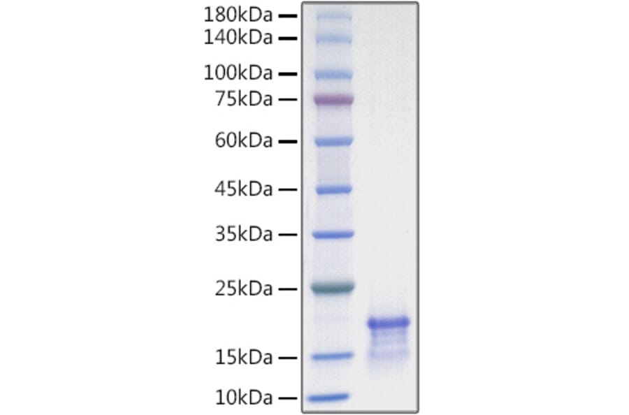 SDS-PAGE - Recombinant Human CCL21 Protein (A330203) - Antibodies.com