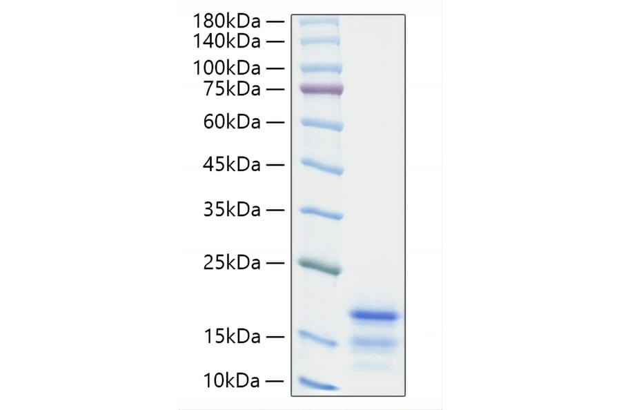 SDS-PAGE - Recombinant Mouse Ccl21a Protein (C-terminal His Tag) (A330204) - Antibodies.com