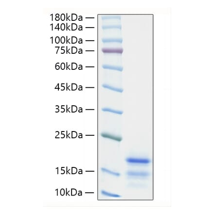 SDS-PAGE - Recombinant Mouse Ccl21a Protein (C-terminal His Tag) (A330204) - Antibodies.com