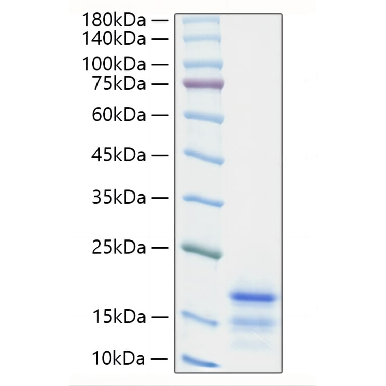 SDS-PAGE - Recombinant Mouse Ccl21a Protein (C-terminal His Tag) (A330204) - Antibodies.com