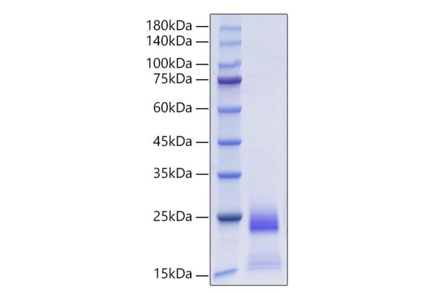 SDS-PAGE - Recombinant Human CCL25 Protein (C-terminal His Tag) (A330206) - Antibodies.com