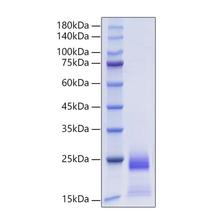 SDS-PAGE - Recombinant Human CCL25 Protein (C-terminal His Tag) (A330206) - Antibodies.com