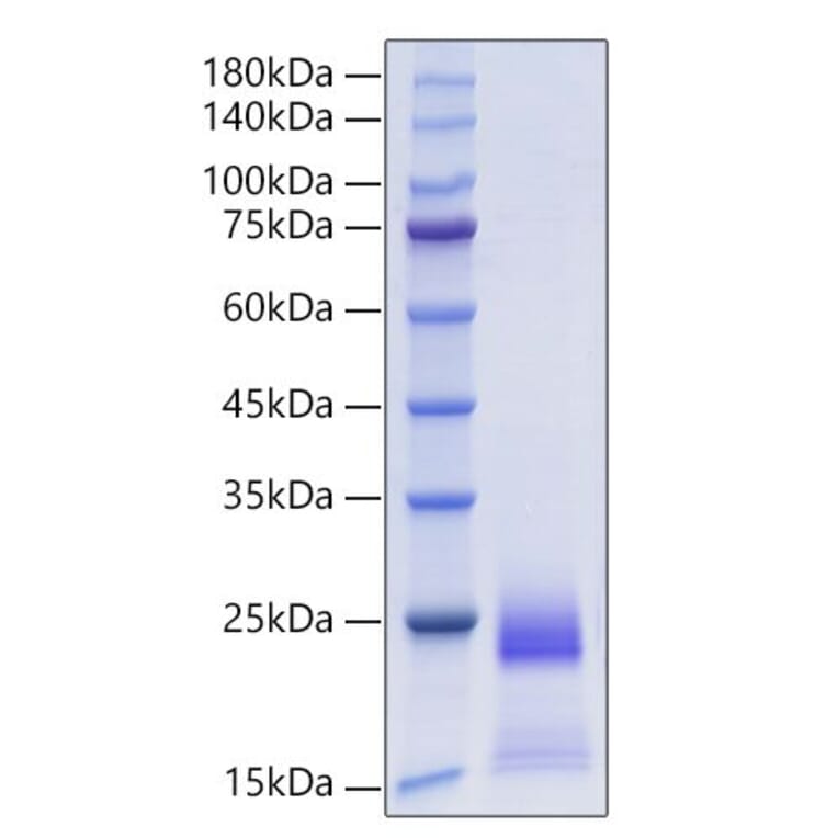 SDS-PAGE - Recombinant Human CCL25 Protein (C-terminal His Tag) (A330206) - Antibodies.com