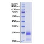 SDS-PAGE - Recombinant Human CCL25 Protein (C-terminal His Tag) (A330206) - Antibodies.com