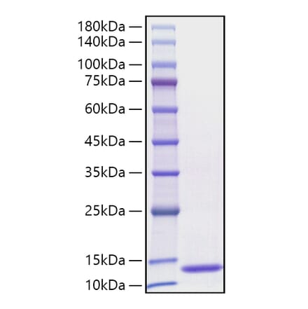 SDS-PAGE - Recombinant Human CCL3 Protein (C-terminal His Tag) (A330209) - Antibodies.com