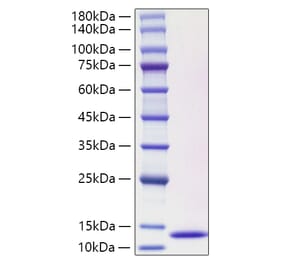 SDS-PAGE - Recombinant Human CCL3L1 Protein (C-terminal His Tag) (A330210) - Antibodies.com