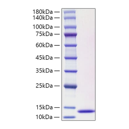 SDS-PAGE - Recombinant Human CCL3L1 Protein (C-terminal His Tag) (A330210) - Antibodies.com