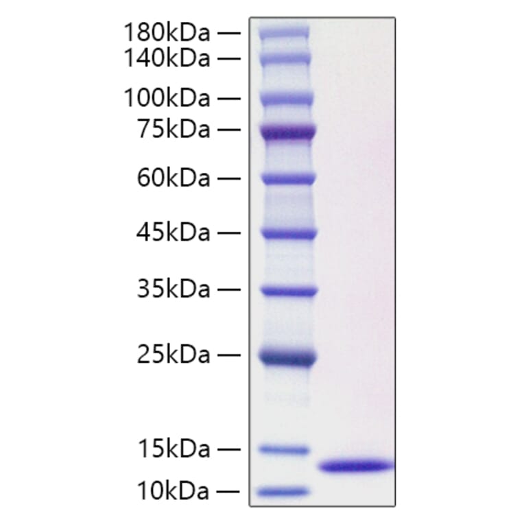 SDS-PAGE - Recombinant Human CCL3L1 Protein (C-terminal His Tag) (A330210) - Antibodies.com