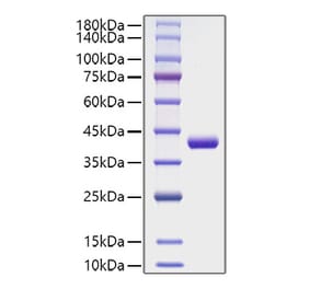 SDS-PAGE - Recombinant Human CCL4 Protein (C-terminal Human Fc Tag) (A330211) - Antibodies.com