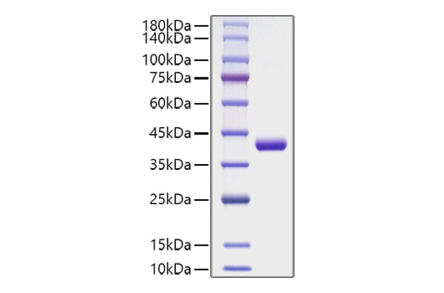 SDS-PAGE - Recombinant Human CCL4 Protein (C-terminal Human Fc Tag) (A330211) - Antibodies.com