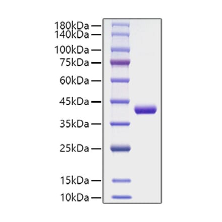 SDS-PAGE - Recombinant Human CCL4 Protein (C-terminal Human Fc Tag) (A330211) - Antibodies.com