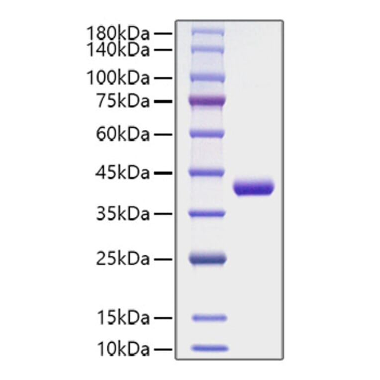 SDS-PAGE - Recombinant Human CCL4 Protein (C-terminal Human Fc Tag) (A330211) - Antibodies.com