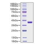 SDS-PAGE - Recombinant Human CCL4 Protein (C-terminal Human Fc Tag) (A330211) - Antibodies.com