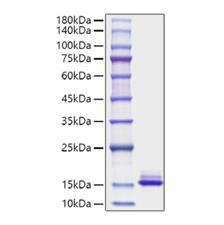 SDS-PAGE - Recombinant Mouse CCL6 Protein (C-terminal His Tag) (A330212) - Antibodies.com