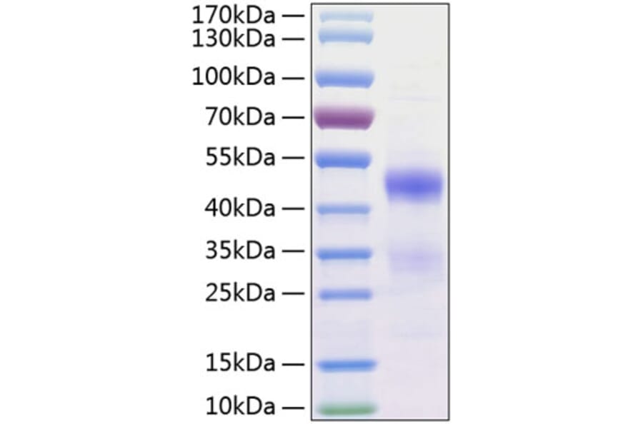 SDS-PAGE - Recombinant Human CCN3 Protein (C-terminal His Tag) (A330213) - Antibodies.com