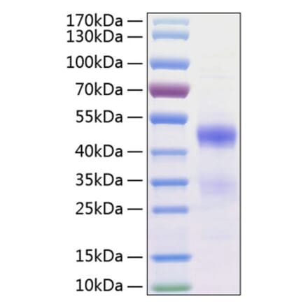SDS-PAGE - Recombinant Human CCN3 Protein (C-terminal His Tag) (A330213) - Antibodies.com