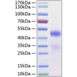 SDS-PAGE - Recombinant Human CCN3 Protein (C-terminal His Tag) (A330213) - Antibodies.com