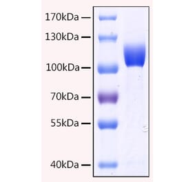 SDS-PAGE - Recombinant Human CD10 Protein (C-terminal His Tag) (A330214) - Antibodies.com