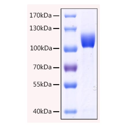 SDS-PAGE - Recombinant Human CD10 Protein (C-terminal His Tag) (A330214) - Antibodies.com