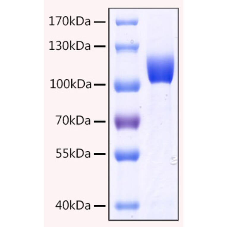 SDS-PAGE - Recombinant Human CD10 Protein (C-terminal His Tag) (A330214) - Antibodies.com