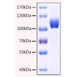 SDS-PAGE - Recombinant Human CD10 Protein (C-terminal His Tag) (A330214) - Antibodies.com