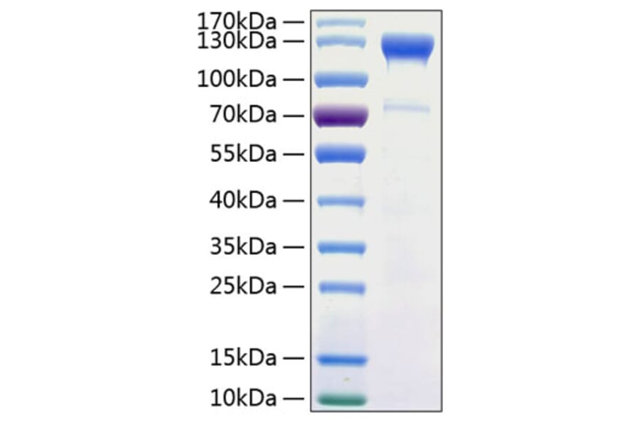 SDS-PAGE - Recombinant Human CD100 Protein (C-terminal His Tag) (A330215) - Antibodies.com