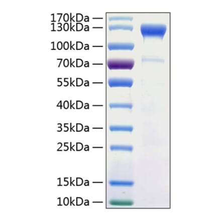 SDS-PAGE - Recombinant Human CD100 Protein (C-terminal His Tag) (A330215) - Antibodies.com
