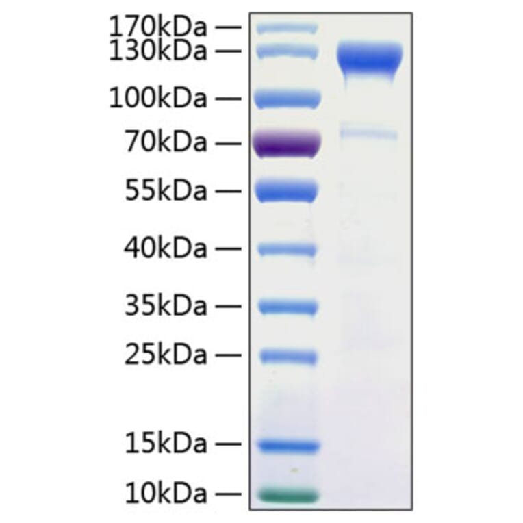 SDS-PAGE - Recombinant Human CD100 Protein (C-terminal His Tag) (A330215) - Antibodies.com
