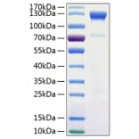 SDS-PAGE - Recombinant Human CD100 Protein (C-terminal His Tag) (A330215) - Antibodies.com