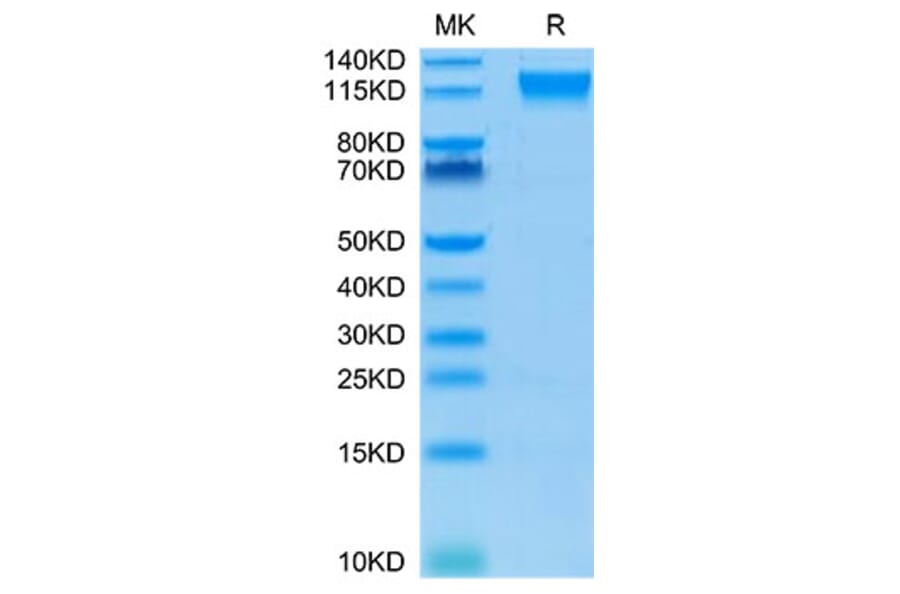 Tris-Bis PAGE - Recombinant Human CD100 Protein (Biotin) (C-terminal His and Avi Tag) (A330216) - Antibodies.com