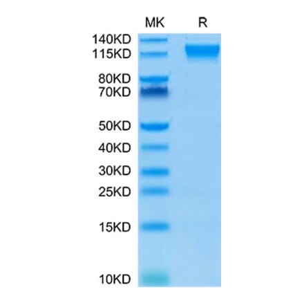 Tris-Bis PAGE - Recombinant Human CD100 Protein (Biotin) (C-terminal His and Avi Tag) (A330216) - Antibodies.com
